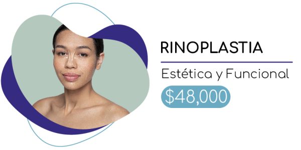rinoplastia-precios-2-02 rinoplastia-precios-2-02